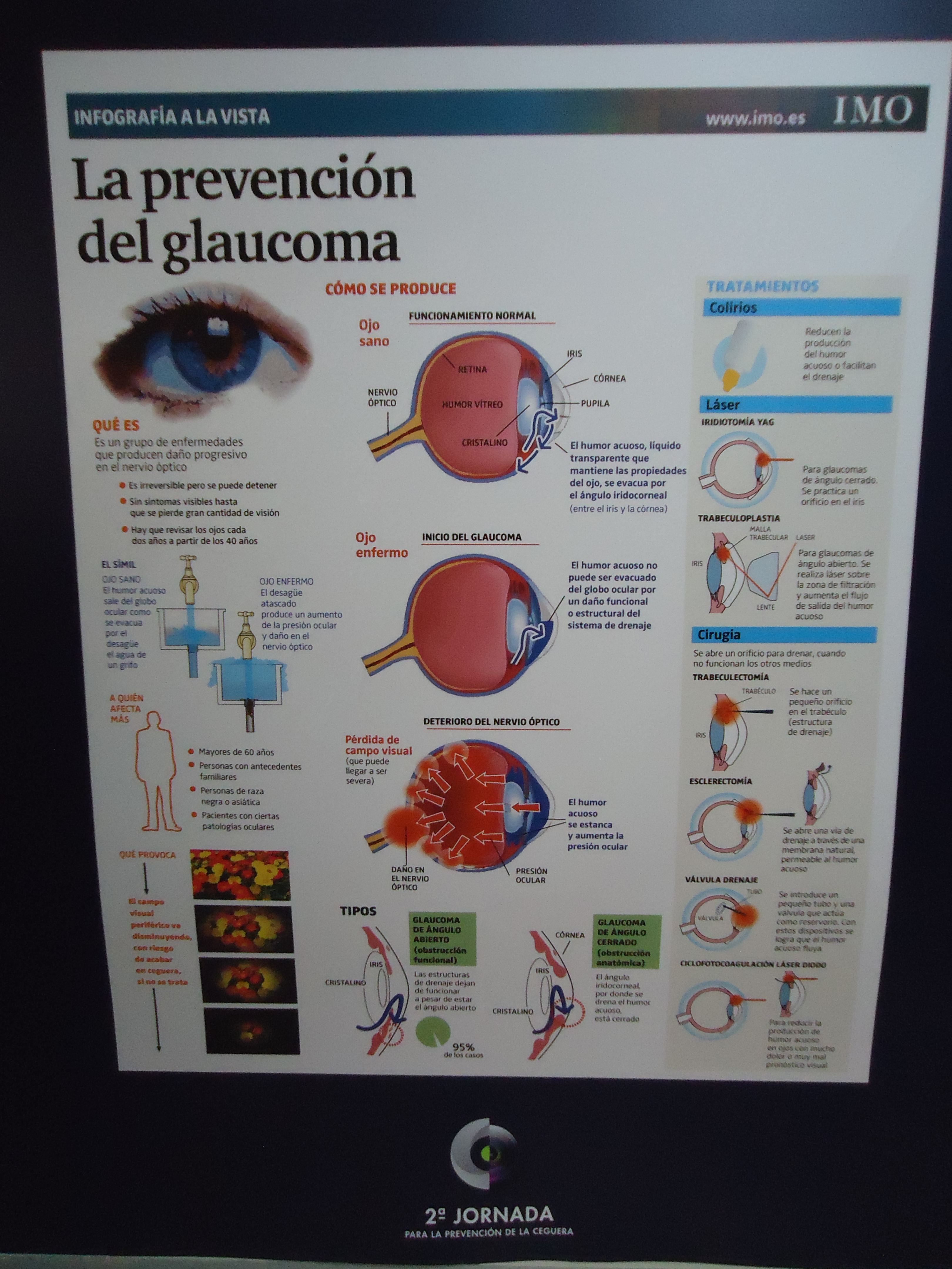 Mirada Andalucía_Panel Glaucoma